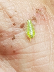 Mediastinia