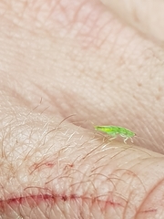 Mediastinia