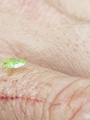 Mediastinia