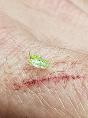 Mediastinia