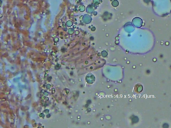 Resupinatus striatulus