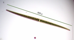 Closterium turgidum