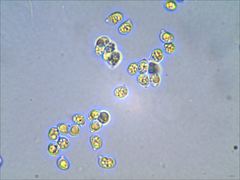 Tricholoma subaureum