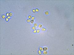 Tricholoma subaureum