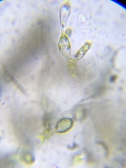 Fritschiella tuberosa