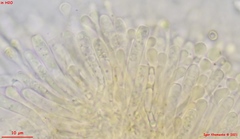 Orbilia xanthostigma