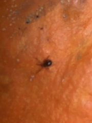 Steatoda grossa