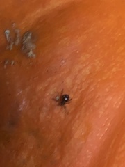 Steatoda grossa