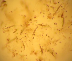Chaenothecopsis