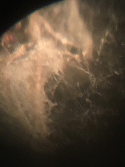 Trichoderma harzianum