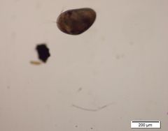 Cypridoidea