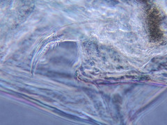 Bosmina longirostris