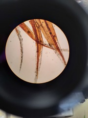 Racomitrium curiosissimum