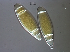 Bactridium ellisii