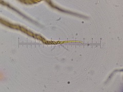 Trichia crateriformis