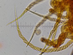 Trichia crateriformis