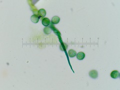 Trichia crateriformis