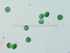 Trichia crateriformis