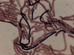 Bacillus simplex