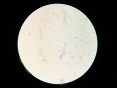 Phloeospora ulmi