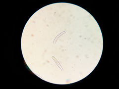 Phloeospora ulmi