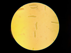 Phloeospora ulmi