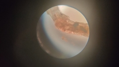 Chironomidae