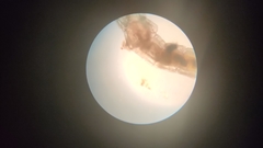 Chironomidae