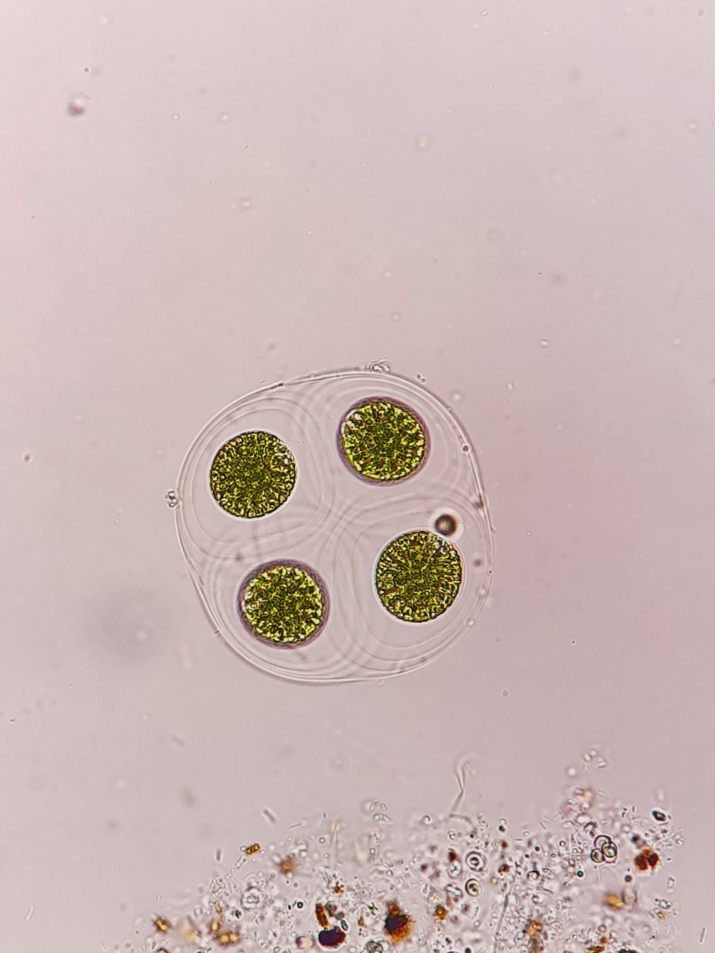 Asterococcus