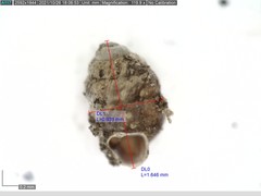 Vertigo angustior