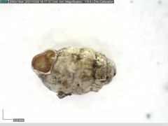 Vertigo angustior