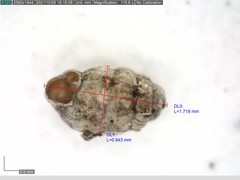Vertigo angustior