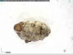 Vertigo angustior