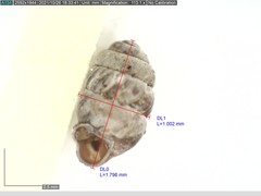 Vertigo angustior