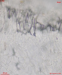 Hymenoscyphus immutabilis