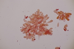 Lepiota oreadiformis