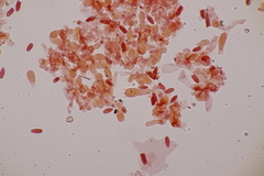 Lepiota oreadiformis