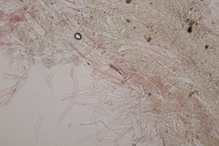 Lepiota oreadiformis