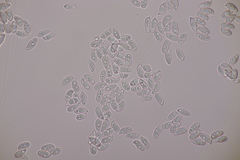 Lepiota oreadiformis