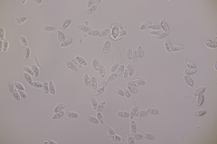 Lepiota oreadiformis