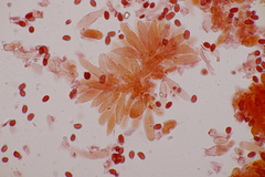 Lepiota pseudolilacea