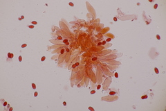 Lepiota pseudolilacea