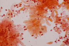 Lepiota pseudolilacea