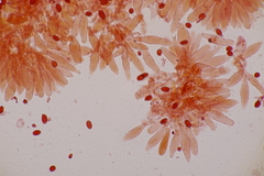 Lepiota pseudolilacea