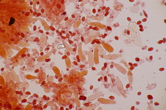 Lepiota pseudolilacea