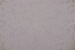 Lepiota pseudolilacea