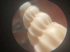 Epitonium multistriatum