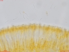 Orbilia xanthoguttulata