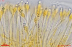 Orbilia xanthoguttulata