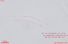 Orbilia xanthoguttulata